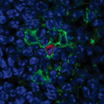 Image: Mark Anderson, MD, PhD, led a team that identified an immune cell, called eTAC cells (shown in green), that may help prevent autoimmune diseases. ETAC cells, which contain a protein in their nucleus called AIRE (shown in red) are relatively rare, and found in lymph nodes and the spleen (Photo courtesy of the University of California, San Francisco (UCSF)).